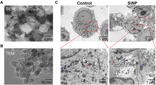 Figure 1 Characterization of silica nanoparticles (SiNPs) in vitro. (A and B) Images of scanning electron microscopy (SEM) and transmission electron microscopy (TEM) showing SiNP in the forms of powder and solution. (C) TEM images showing the phagocytosis of SiNPs by RAW-ASC cells. RAW-ASC cells were pretreated with LPS for 6 h and then exposed to SiNP for 4 h. The control group received sham interventions. Black Arrow: SiNP; Red arrow: Golgi apparatus; Blue Arrow: Mitochondria.