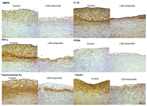 Figure 4 Immunohistochemistry of artery tissues from rabbits treated with saline solution (control group) or LDE-etoposide. Photomicrographs of diaminobenzidine chromogen immunostaining for MMP9, IL-1β, TNF-α, PCNA, topoisomerase IIα, tubulin. Magnifications: 100×.Abbreviations: IL, interleukin; LDE, cholesterol-rich nanoemulsion; MMP9, matrix metallopeptidase 9; PCNA, proliferating cell nuclear antigen; TNF, tumor necrosis factor.