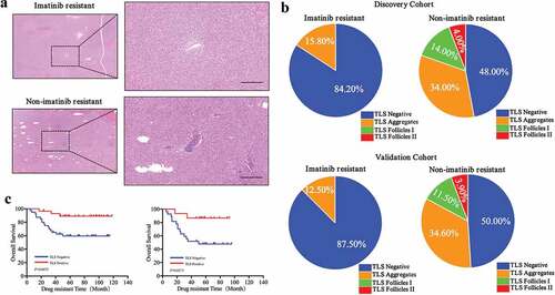 Figure 3. Differences of TLS phenotype between imatinib resistant patients and non-imatinib resistant patients