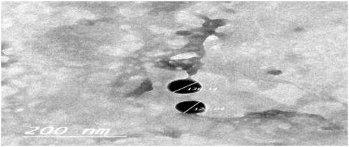 Figure 2. Transmission-electron micrograph (TEM) of the optimized agomelatine loaded solid lipid nanoparticles in situ gel formula.