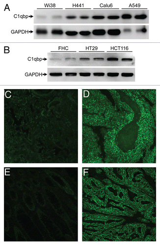 Figure 6 C1qbp is upregulated in human lung and colon cancer cell lines and tumors. (A) Protein gel blotting for C1qbp in the normal lung Wi38 cell line and in the H441, Calu-6 and A549 lung cancer cell lines. GAPDH was used as a loading control. (B) Protein gel blotting for C1qbp and GAPDH in the normal colon FHC cell line and in the HT-29 and HCT-116 colon cancer cell lines. (C–F) Fluorescent immunostaining for C1qbp in sections from: (C) normal human lung tissue; (D) small cell lung carcinoma; (E) normal human colon tissue and (F) colon invasive adenocarcinoma (well differentiated, mucinous). The results shown are representative of 3 and 4 independent experiments performed in duplicate (cell lines) or 4 different patient samples (tumors).