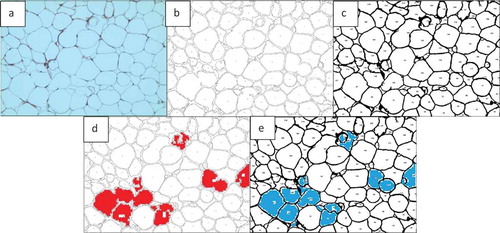 Figure 17. Output of cell counting results for. Figure 16(a). a) Original Image of adipose tissue histology. b) ImageJ image. c) AdipoGauge image. d) Cells that were counted differently in ImageJ in red. e) Cells that were counted differently in AdipoGauge in blue