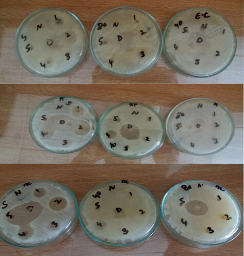 Figure 10. Antimicrobial activities of γ-irradiated and non-irradiated bionanocomposite films against (A) Escherichia coli, (B) Klebsiella pneumonia, and (C) Acetobacter aceti.