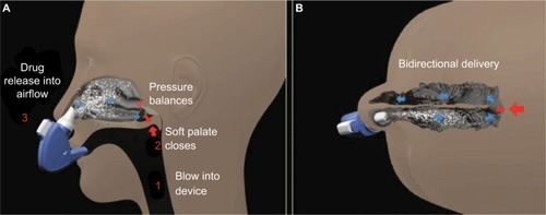 Figure 3 Illustration of breath-powered intranasal delivery.