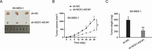 Figure 5. NCK1-AS1 silencing led to the inhibition of in vivo tumor growth