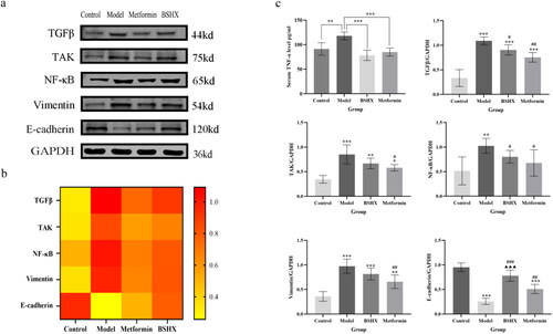 Figure 6. Serum TNF-α levels, and levels of target proteins and EMT-related proteins in rat endometrial tissue. a: Endometrial TGF-β, TAK, NF-κB, E-cadherin, and Vimentin WB results. b: Endometrial TGF-β, TAK, NF-κB, Vimentin Heatmap Display. c: Serum TNF-α levels in rats (*p < .05, **p < .01, ***p < .001). Levels of TGFβ, TAK, and NF-κB in rat endometrial tissue and levels of EMT-related proteins Vimentin and E-cadherin in the endometrium. Data are shown as mean ± SD (n = 5), and data between multiple groups were compared by one-way ANOVA. Compared with the control group: *p < .05, **p < .01, ***p < .001; compared with the model group: #p < .05, ##p < .01, ###p < .001; compared with the metformin group: ▲p < .05, ▲▲p < .01, ▲▲▲p < .001.