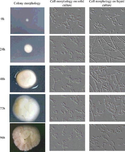 Figure 1. Colony and cell morphology of T. cutaneum B3 cultivated on YEPD solid and liquid culture medium. The cells were photographed at 1000× magnification. Inoculum condition was 100% yeast-like morphology.
