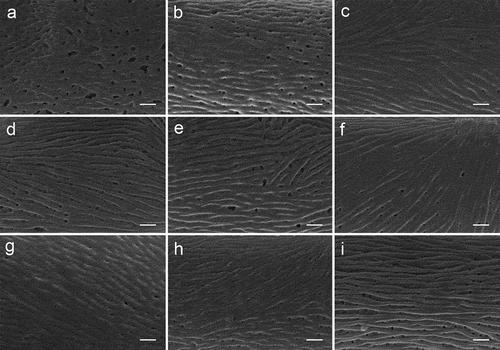 Figure 5. Pollen micrographs of Sorbus (SEM). S. alnifolia(a), S. amabilis(b), S. folgneri(c), S. koehneana(d), S. megalocarpa(e), S. meliosmifolia(f), S. prattii(g), S. sargentiana(h), S. scalaris(i). Scale bars−1 μm.