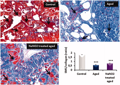 Figure 5. Masson's trichrome staining of cavernous tissue from young control, aged and NaNO2-treated aged rats. Smooth muscle and connective tissues are stained in red and blue, respectively. Smooth muscle cell (SMC)/collagen ratio determined by Masson trichrome staining on paraffin-embedded penile tissue sections was shown in the lower bar graphic. Please notice blue areas were markedly enhanced in aged rats when compared to control rats. However NaNO2 treatment slightly enhanced red areas in aged samples, but it was not significant when compared to control samples (***p<0.001).