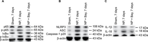 Figure 4 Suppression of activation of NF-κB, formation of NLRP3 inflammasome, and production of IL-1β and IL-18 in DRGs of NP-treated rats by Bay11-7082 (Bay).