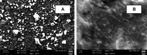 Figure 3 Scanning electron microscope images of wollastonite.Notes: (A) At lower magnification. (B) At higher magnification.