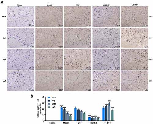 Figure 4. The BDNF/TrkB signaling pathway influenced the proliferation and survival of new cells in vestibular nucleus (MVN, IVN, SVN and LVN). (a) Photomicrographs showing BrdU immunostainings in vestibular nucleus (MVN, IVN, SVN and LVN) 3 d after unilateral labyrinthectomy with continuous drug infusion in the fourth ventricle (artificial CSF, siBDNF, or 7, 8-DHF). (b) The relative BrdU-positive cell in the vestibular nucleus from each group was determined. CSF, cerebrospinal fluid; 7,8-DHF, a TrkB Agonist. *** p < 0.001 vs. counterparts in Sham; ### p < 0.001 vs. counterparts CSF group