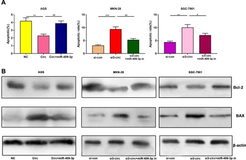 Figure 3 Circ_0001023/miR-409-3p axis regulates the metastasis of GC cells. (A) Overexpressed circ_0001023 inhibited the apoptosis of AGS cells, and this inhibitory effect was partially weakened by miR-409-3p mimics. Knock-down circ_0001023 induced apoptosis of MKN-28 and SGC-7901 cells, and miR-409-3p inhibitors partially reversed this promoting effect. (B) The expression levels of Bcl-2 and Bax were detected by Western blot. *, **, and *** represent p<0.05, p<0.01, and p< 0.001, respectively. # and ## represent p<0.05 and p<0.01, respectively.