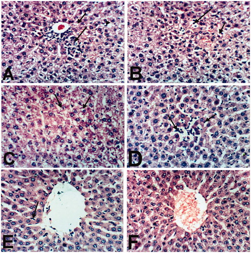 Figure 2. Liver of rat treated with (A) indomethacin showing cytoplasmic vacuolation of hepatocytes (small arrow), small focal hepatic necrosis associated with inflammatory cells infiltration (large arrow) and Kupffer cells activation (arrow head). (B) Indomethacin showing cytoplasmic vacuolation of hepatocytes (small arrow) and sinusoidal leukocytosis (large arrow). (C) BCO showing cytoplasmic vacuolization of hepatocytes (arrows) and Kupffer cells activation (large arrow). (D) COO showing Kupffer cells activation (small arrow) and sinusoidal leukocytosis (large arrow). (E) CLO showing slight activation of Kupffer cells (arrow). (F) Control showing the normal histological structure of hepatic lobule. (H & E x 400).