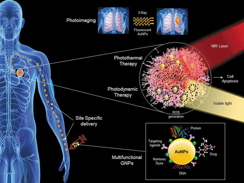 Figure 1. Different approach GNPs for cancer diagnostics and treatment