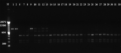 Fig. 4 Representative gel photograph of PCR-RFLP of the ITS1-ITS2 regions of M. roreri using restriction enzymes. The lane numbers on the gels correspond to the sample codes in Supplementary Table 1. M indicates the DNA ladder.