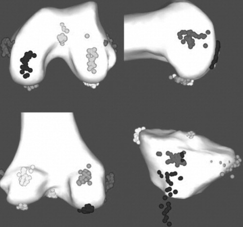 Figure 3. 3D visualization of the large variability for different landmarks acquired manually. For visualization only, these manual landmarks have been displayed on the BoneMorphing 3D models (color version available at online).