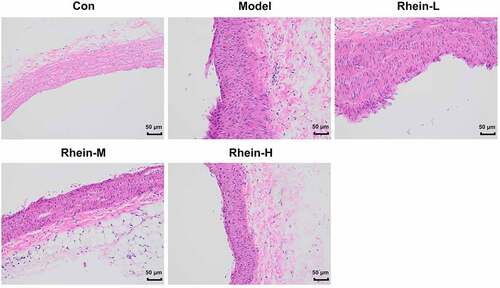 Figure 4. The effects of rhein on pathological changes of blood vessel were evaluated by HE staining. After the rats of different groups were fed by the following administration, respectively, for six weeks, respectively: normal chow, high-fat diet (HFD) (D12492, 60% kcal%, Research Diets, USA), high-fat diet +Rhein-L (lose dose), high-fat diet (60% kcal%) + Rhein-M (medium dose), high-fat diet (60% kcal%) +Rhein-H (high dose), blood vessel tissue was collected