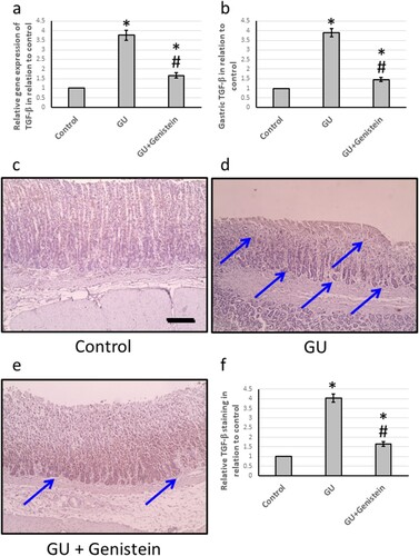 Figure 5. Effect of gastric ulcer (GU) and 25 mg/kg genistein on gene expression of transforming growth factor (TGF)-β (a) and its protein level in gastric tissues (b). Gastric sections stained with anti-TGF-β in control group (c), GU group (d) and GU treated with genistein (e), as well as immunohistochemistry score of positive staining (f). Blue arrows indicated areas of immunostaining. Scale bar 100 μm. * Significant difference as compared with control group at p < 0.05. # Significant difference as compared with GU group at p < 0.05.