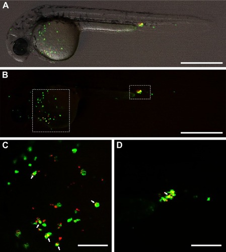 Figure 8 Co-localization of green fluorescent zebrafish macrophages (green) and red fluorescent S. aureus at 2 hours after intravenous injection of bacteria into a 1-day-old zebrafish larva. The median dose of S. aureus assessed directly after injection in 6 control larvae was 3,000 CFU/larva. (A) Merged overview image; (B) distribution of the fluorescent macrophages and injected S. aureus; white dashed boxes indicate the areas of the recorded co-localization enlarged in C and D; (C and D) high magnification of the recorded co-localization, indicated by arrows. Scale bars in A–B and C–D represent 500 and 100 μm, respectively.Abbreviation: CFU, colony-forming unit.