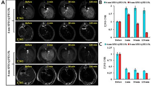 Figure 4 (A) SD rats hepatic T1-T2 dual-mode imaging before and after intravenous injection of 4-nm SPIO@PEG5k or 8-nm SPIO@PEG5k; (B) NSI in liver parenchyma on T1WI; (C) NSI in liver parenchyma on T2WI.