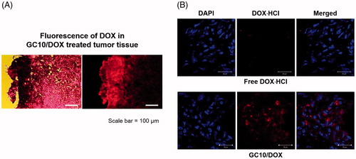 Figure 6. (A) Fluorescence images of DOX in dissected tumors extracted from free DOX⋅HCl and GC10/DOX treated mice and (B) their H&E stained images. The white scale bar indicates 20 μm.