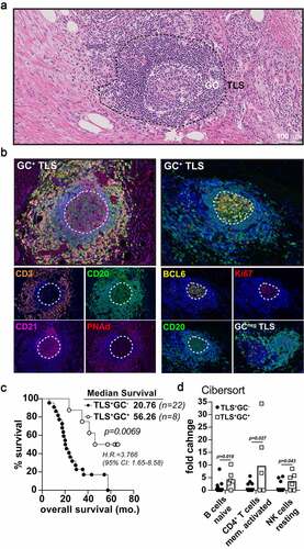 Figure 4. Germinal center reactions identify mature TLS associated long term PDAC survivorship. A-B) Representative 20x H&E micrograph (a) followed by multispectral IHC images (b) demonstrating germinal center marker expression (CD21, BCL6, Ki67) in the midst of CD3 (T cells) peripheral clusters, PNAd+ HEV, and CD20 (B cells) zones. The image on the bottom right in (B) is an example of a GC-negative, early-TLS aggregate lacking BCL6 and Ki67 B cell zones. C) Kaplan-Meier overall survival analysis comparing TLS+GC− patients (n = 20) and TLS+GC+ patients (n = 8) in the Providence upfront resectable cohort. D) CIBERsort analysis on tumor RNA-seq data was performed for both GC+ and GC− groups in the PCI cohort and significant fold enrichment changes are shown for naïve B cells, activated CD4+ T memory cells, and resting NK cells as indicated