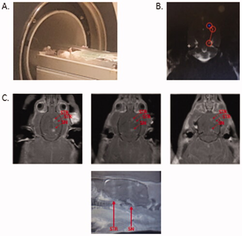 Figure 6. MR-guided FUS induced permeabilization of the blood brain barrier. (A) Anesthetized rat in the MRI with rodent attachment. (B). T1-weighted image following gadolinium contrast agent (0.2 mL/kg, GE Healthcare) administration to locate and target the striatum (two sites) and substantia nigra (one site). (C). T1-weighted images following tail-vein infusion via catheter of AAV2-SIRT3-myc conjugated to microbubbles (300–400 µl) and application of sonication at targeted sites in the striatum (ST) and substantia nigra (SN) (0.4 MPa fixed pressure, 1 ms pulse length, 1 Hz pulse repetition frequency, 120 s duration). MR imaging with gadolinium shows FUS-targeted areas as bright regions (red arrows), indicating BBB permeabilization, and that gadolinium diffused into the SNc and ST. n = 5.