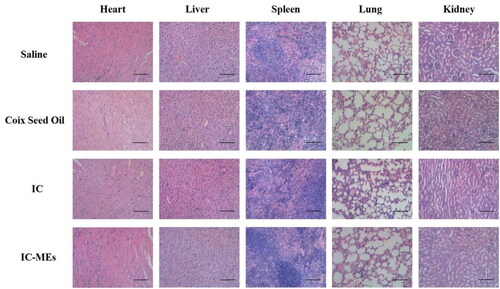 Figure 11. H&E staining of heart, liver, spleen, lung, and kidney of various formulation groups. Scale bar: 100 μm.