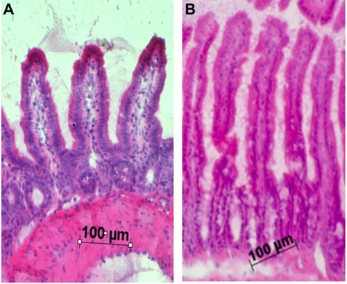 Figure 3 Representative H&E stained sections from jejunum. (A) Lean control mouse jejunum. (B) ob/ob mouse jejunum.