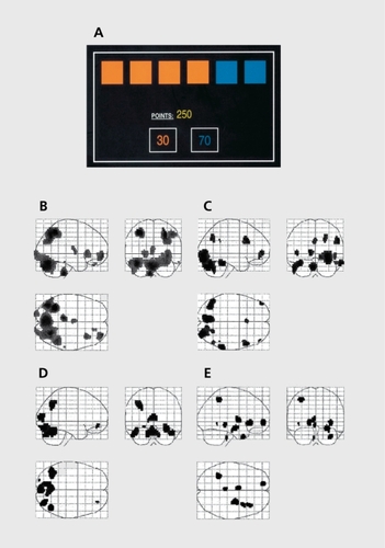 Figure 1. Brain responses during risky decision-making in patients with mania, patients with depression, and healthy controls. A: Screen display for the Risk Task. Subjects are instructed that a token has been hidden at random under one of the six boxes. They must guess whether the token is hidden under a red or blue box, in order to win points. The less likely option (blue, in this example) is also associated with a higher win value, to create conflict between reward and uncertainty. Blocks of decision-making were contrasted with a visuomotor baseline condition. B: Activations during decision-making in healthy controls. C: Activations during decision-making in patients with mania. D: Activations during decision-making in patients with major depressive disorder. E: Areas of increased activity in healthy controls relative to patients with mania. Reproduced from ref 68: Rubinsztein JS, Fletcher PC, Rogers RD, et al. Decision-making in mania; a PET study. Brain. 2001;124:2550-2263. Copyright © Oxford University Press 2001