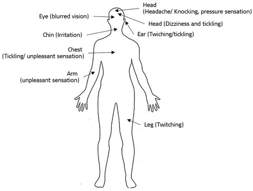 Figure 9. Nonauditory sensations on different parts of the body as felt by the ABI implanted patients (image courtesy of MED-EL).