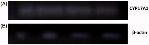 Figure 4. Gene expression of different groups using PCR: (A) CYP17A1 expression; (B) β-actin gene expression. In each image, first band was of the normal group, second was of the diseased group, third was of the metformin-treated group, and the fourth was the quercetin-treated group. The fifth band in each image is DNA ladder for the comparison of base pair size of PCR product expressed.