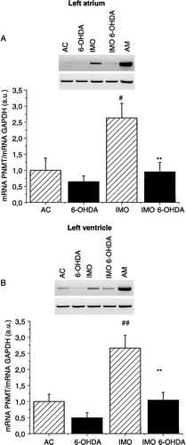 Figure 2 PNMT mRNA expression measured by RT-PCR in myocardium from the left atrium (A) and left ventricle (B). Typical gels for PNMT and GAPDH mRNAs are shown above the corresponding histograms. Significantly greater PNMT mRNA expression was observed in the vehicle-treated immobilized group of rats (IMO) compared to control (AC). After treatment with 6-OHDA, no immobilization-induced increase (IMO 6-OHDA) was observed. Results are presented as group mean ± SEM, n = 6–7 rats per group. Statistical significance for AC vs. IMO: #p < 0.05 and ##p < 0.01; significance between IMO and IMO 6-OHDA: **p < 0.01.