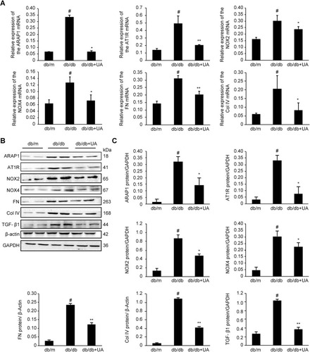 Figure 4 Protein and mRNA expression in the renal cortex of 20-week-old mice as detected by Western blotting and RT-qPCR, respectively. (A) Changes in ARAP1, AT1R, NOX2, NOX4, FN and Col IV mRNA expression as detected by RT-qPCR. (B) Changes in the levels of ARAP1, AT1R, NOX2, NOX4, FN, Col IV, and TGF-β1 proteins were detected using Western blotting. #p<0.01 compared with db/m mice; *p<0.05 and **p<0.01 compared with diabetic db/db mice.