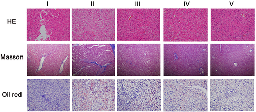 Figure 3 Effect of NC-CS/PT-NPs on pathological changes of liver tissue in NAFLD mice (HE staining, Masson staining, Oil red staining; ×200).