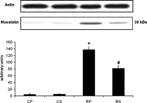 Figure 1  The effect of restraint and Sutherlandia supplementation on myostatin in gastocnemius muscle. Samples were analysed by western blotting with antibodies recognizing myostatin. Results are expressed as means ± SEM for eight independent experiments, *p < 0.001 vs. CP; #p < 0.001 vs. RP, F = 86.86. CP, control placebo; CS, control Sutherlandia; RP, restraint placebo; RS, restraint Sutherlandia.