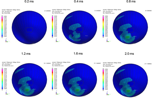 Figure 3 Sequential strain strength response of ocular surface of model eye upon airbag impact in 30° gaze-down position at 40 m/s with adhesion strength of scleral flap of 100%, shown in 0.4-ms intervals after 0.2 ms. Strain strength change is displayed in color as presented in the color bar scale (Figure 2).