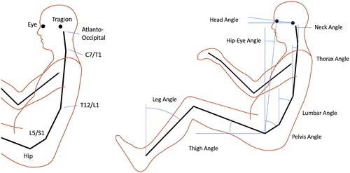 Figure 2. Landmarks, joints, and posture variables. Angles are positive as shown except for neck angle.