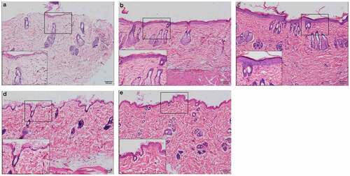 Figure 3. Rat skin histopathological changes at different points with HE staining (100 fold and 400 fold) a. rat skin histopathological before irradiation. b. 7 days after UVB irradiation in NS treatment group. c. 7 days after UVB irradiation in PRP treatment group. d. 28 days after UVB irradiation in NS treatment group. e. 28 days after UVB irradiation in PRP treatment group