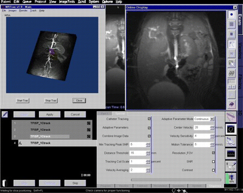 Figure 1. Screenshot of interventional interface. (View this art in color at www.dekker.com.)