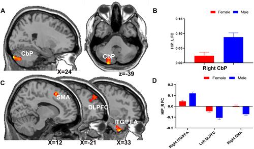 Figure 2 The main effect of gender on the hippocampus functional network. The main effect of gender on the left hippocampus functional network (located on the right CbP) (A and B); the main effect of gender on the right hippocampus functional network (located on the left DLPFC, right SMA, ITG, and FFA) (C and D).