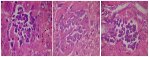 Figure 2b. Cyclophosphamide (150 mg/kg)-treated group, a section of mouse liver showing portal inflammation, hepatocellular necrosis, and lymphocytic inflammatory infiltrations (Hematoxylin and eosin-stained paraffin section; H&E 400).