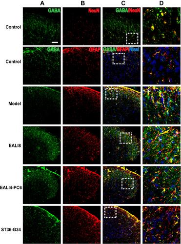 Figure 5 GABA is mainly expressed in neurons and astrocytes. Representative confocal microscopic images of C4-C5 spinal cord sections showing the co-expression of GABA (green) and NeuN (red, marker for Neuron), GFAP (red, marker for astrocytes) and Nissl (blue, marker for basic neuronal structure) in the superficial laminae of the spinal cord C4-C5 DHs at 24h after modeling in rats. The co-localization of GABA and GFAP staining appears in yellow. The bar labeled on the top-left image represents 50µm. (A) GABA, (B) NeuN or GFAP, (C) merge, (D) magnification of the dashed squares from their left merged images.