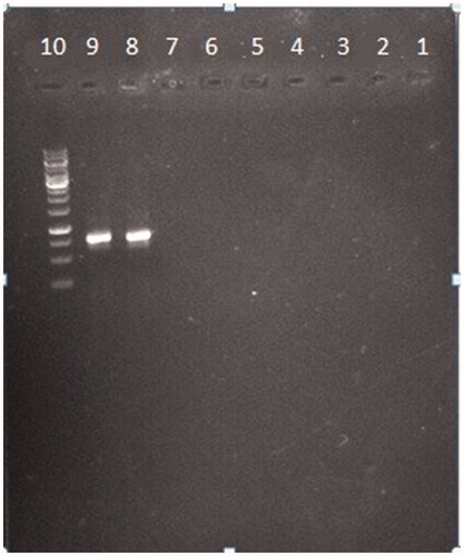 Figure 2. Evaluation of specificity. Nine common bacteria in UTI including 2 E. coli with PTCC number were subjected to the PCR. Each number is related to each of the bacteria specimen. (1) Klebsiella pneumonia. ATCC 70603. (2) Staphylococcus haemolyticus PTCC 1437. (3) Streptococcus pyogenes PTCC 1447. (4) Enterococcus faecalis ATCC 29212. (5) Pseudomonas aeruginosa ATCC 27863. (6) Proteus mirabilis ATCC 25933. (7) Serratia marcescens ATCC 13880. (8) E. coli PTCC1270. (9) E. coli PTCC 127.