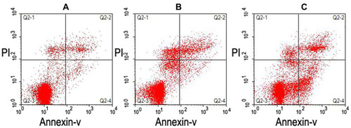 Figure 2 Sperm apoptosis as determined using flow cytometry. (A and B) Lower levels of apoptosis (2.82% and 3.02%, respectively). (C) Higher levels of apoptosis (17.46%).