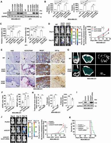 Figure 1. Loss of ULK1 in breast cancer cells increases breast cancer bone metastasis. (A) Immunoblot in MDA-MB-231 cells or 4T1 cells expressing sgRNAs targeting ULK1, then rescued with ULK1 cDNA. (B and C) Quantitative analysis of the migratory and invasive ability of the indicated MDA-MB-231 cells (B) and 4T1 cells (C) exposed to hypoxic conditions. Quantification of migratory and invasive cells in each group. The migration or invasion of control cells (WT) was set as 100%. (D) The luciferase-tagged WT or ULK1-knockout MDA-MB-231 cells were injected intracardially. BLI images showed representative mice in each group (left). Normalized bone metastasis BLI signals from mice (n = 5, right). (E) Representative histological images of bones from each experimental group mice in (D). Arrows indicate areas of overt bone destruction in ACP5/TRAP images. (F) Quantification of ACP5/TRAP+ osteoclasts and IHC analysis of MKI67/KI-67 from decalcified histological hind limb sections in (D). (G) Micro CT imagines from a representative mouse in each group in (D). (H) Quantification of trabecular bone volume relative to total volume, trabecular numbers and trabecular thickness from representative micro CT scans in (D). Regions of interest for trabecular bone scan and analysis are marked by green. (I) MDA-MB-231 cells were stably transfected with ULK1 shRNA, then rescued with ULK1 cDNA. (J) the indicated luciferase-tagged MDA-MB-231 cells were injected intracardially. BLI images showed representative mice in each group (left). Normalized bone metastasis BLI signals from mice (n = 7, right). (K) Kaplan-Meier survival curve of mice were calculated (n = 7). Error bars represent mean ± SEM. The P value in (B), (C) was determined by one-way ANOVA with Tukey’s multiple comparisons test, the P value in (D), (F), (J) was determined by one-way ANOVA with Dunnett’s multiple comparisons test, no adjustments were made for multiple comparisons. The P value in (H) was determined by a two-tailed unpaired Student’s t test. The P value in (K) was assessed using the log-rank test. * P < 0.05, ** P < 0.01. Data are representative of two independent experiments