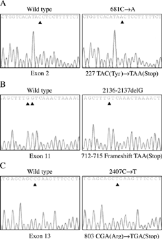 Figure 1. Sequence data showing three PKD2 gene mutations: (A) nonsense mutation Y227X, C681A; (B) frameshift mutation 712-715X, 2136-2137delG; and (C) nonsense mutation R803X, C2407T.
