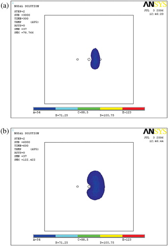 Figure 8. Ablation lesions at different times. (a) T = 300 s; (b) T = 600 s.