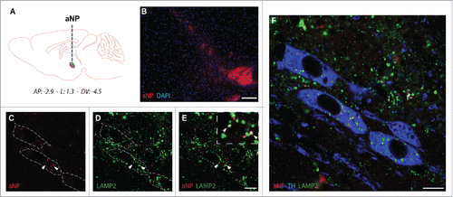 Figure 5. Acidic nanoparticles are detected in lysosomes of dopaminergic neurons after intracerebral injections in mice. (A) Schematic diagram indicating the site of nigral stereotactic LB inoculations in mice. (B) Representative images of PLGA-aNP (in red; nucleus in blue) 5 d after the injection in SNpc. ((C) to F) Colocalization of PLGA-aNP (in red) with LAMP2 (in green) in TH-immunopositive neurons (in blue) in midbrain sections of PLGA-aNP injected mice. Arrowheads highlight colocalization of PLGA-aNP and LAMP2. Scale bars: 100 µm (B); 20 µm ((C)and D).